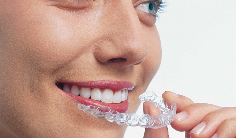 Getting Things Straight – What Exactly is Invisalign?