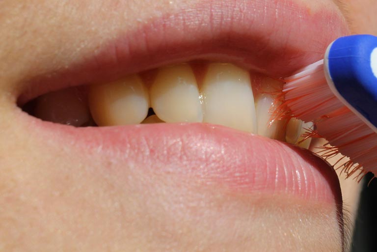 Are You Looking After Your Teeth Correctly?